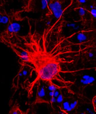Reactive astrocytes can be deadly