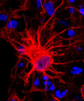 Reactive astrocytes can be deadly