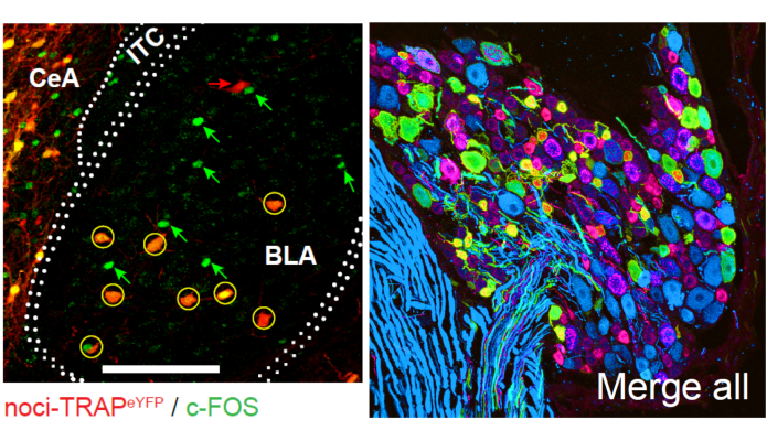 Immunofluorescent image of nociceptive basolateral amygdala (BLA) neurons (red) that were re-activated (c-Fos; green) following a second pin prick to the paw (left). Once identified, these neurons were silenced using chemogenetics. Neurons expressing ChR2-eYFP (green) in peripheral nociceptors (red) of dorsal root ganglia of the spinal cord (right).