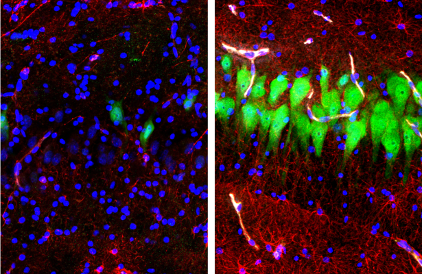 Immunofluorescent stains for neurons (NeuN; green), astrocytes (GFAP; red), and cell nuclei (DAPI, blue) in the hippocampal CA3 region of brains either unperfused for 10 hours after death (left) or subjected to perfusion with the BrainEx technology (right). After 10 hours postmortem, neurons and astrocytes normally undergo cellular disintegration unless salvaged by the BrainEx system.