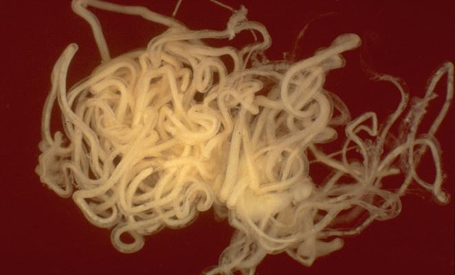 Possible cause discovered for mysterious pediatric epilepsy.