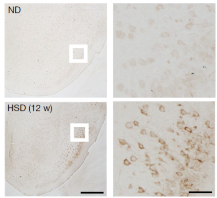 Images showing increased neuronal AT8 immunoreactivity – a marker of increased tau phosphorylation – in the piriform cortex of mice on a normal (ND) and high-salt (HSD) diet. Right images are magnified views of the white boxes on the left.