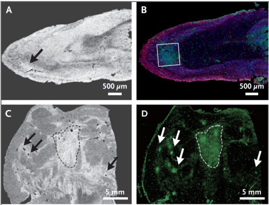 Abnormalities observed brains of patients who died from Covid-19