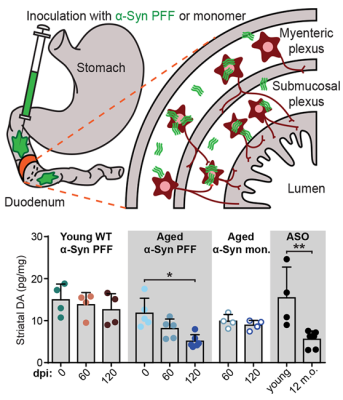 New evidence of gut-brain connection in Parkinson’s disease. Credit: Nature Neuroscience