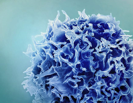 Colorized scanning electron micrograph of a T lymphocyte (also known as a T cell) (blue). 