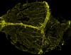 Fluorecence imaging showing dura mater blood vessels in yellow