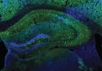 Green neurons in a mouse brain.