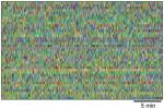 Two blocks of colored pixels. Each pixel represents a mouse behavior or “syllable” and each row shows the behavior pattern of one mouse. The bottom block shows the behavior patterns of mice with epilepsy compared to controls, above. 