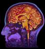 Image of a brain scan.
