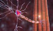 Motor neuron connecting to muscle cells.