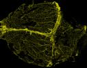 Fluorecence imaging showing dura mater blood vessels in yellow