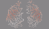 Blood vessels of a mouse brain with expansion shown in red