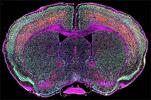 image of a brain scan showing viral genes in ALS