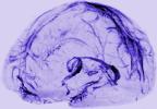 Image of human brain scan showing lymphatic vessels