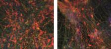 dopamine neurons derived from PD patients and controls