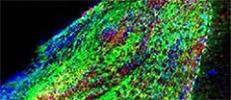 Microscopic image showing that giving a compound called 3K3A-APC to mice with stroke-induced brain damage dramatically increased the production of new neurons (labeled in red) from neural stem cells implanted next to the injured area.
