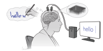 cartoon showing patient thinking about writing while implanted electrodes carry associated brain activity to a computer where it is turned into text on screen