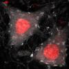 Picture of two neurons from a mouse spinal cord.