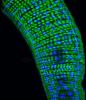 Tube like fly gut colored with blue and green spots.