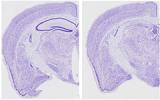 Sections of brains from normal (left) and tauopathy (right) mice. The dark purple lines in the left image represent the hippocampus, the area most responsible for learning and memory. This structure is almost completely absent in the right image