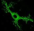 Mossy cells in mice.