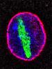 Image of a genetic mutation implicated in ALS and FTD preventing proteins from entering and exiting the cell’s nucleus  