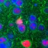 microscopic image of ALS and FTD in a mouse