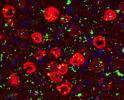 microscopic image of Proteasomes and Brain Cell Death