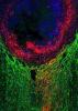 Image of previously injured axons growing through a dense astrocyte scar in the presence of molecules that stimulate growth 