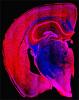 Untangling Dementia