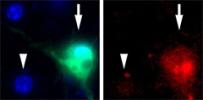 When neurons were grown in a dish (nuclei shown in blue) only those containing LAG3 protein (green) pulled toxic ɑ-synuclein fibrils (red) inside their cell bodies. 
